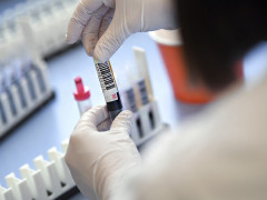 Коронавірус на Київщині: кількість зафіксованих випадків на 19 квітня
