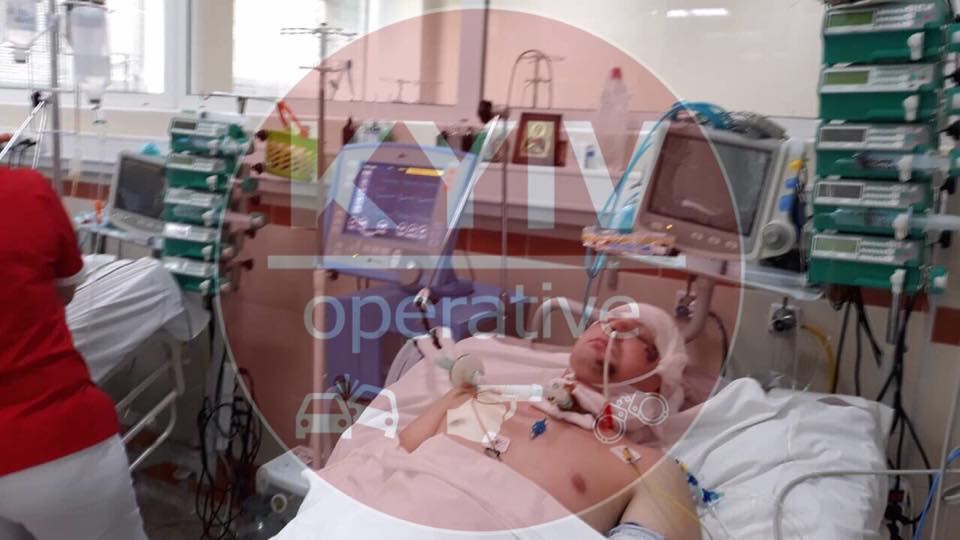 На Київщині чоловік, який потрапив під колеса автомобіля потребує негайної допомоги
