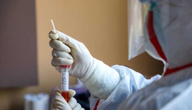 Кількість хворих на COVID–19 на Київщині збільшилась удвічі