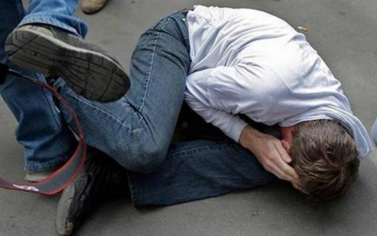 У Білій Церкві пограбували та жорстко побили чоловіка