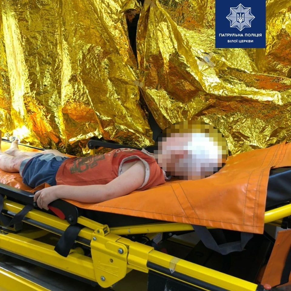 У Білій Церкві врятували 5-річного хлопчика, якого викинули з вікна