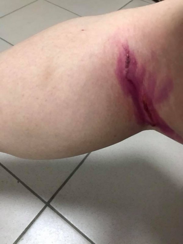 Бродячі собаки покусали жінку в Броварах